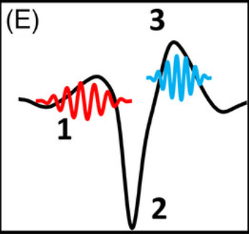 EEG representation of sleep wave patterns