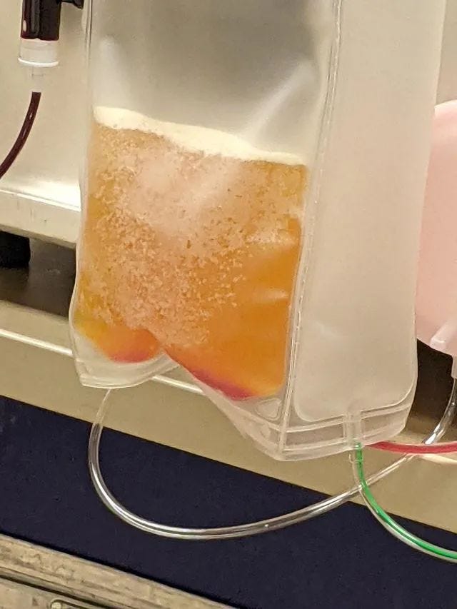 Blood resembling beer