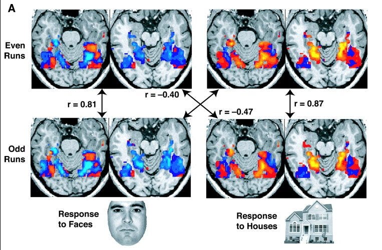 fMRI brain imaging study